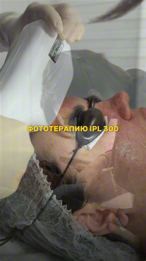 АКНЕ, ПОСТАКНЕ, ПИГМЕНТАЦИЯ — всё это можно решить быстрее, чем вы думаете. В MedUpgrade мы работаем с оборудованием нового поколения — Alvi Prague Light Pro Duo (SHR System), которое воздействует мягко, абсолютно безболезненно, без реабилитации и при этом очень эффективно. Лечение светом помогает ровнять тон кожи, уменьшать воспаления, осветлять пигментацию и улучшать общий вид кожи уже после первых процедур. Если вы давно ищете способ вернуть коже чистоту и гладкость — это ваш знак. MedUpgrade