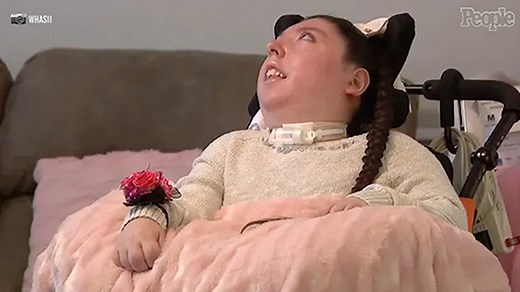 Woman Born Without a Brain Turns 20 After Doctors Believed She Wouldn't Live Past 4 Years Old: 'She's a Fighter'