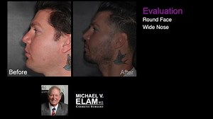 Facial Contouring and Balancing Treatment Options