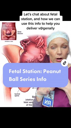 Fetal Station & Peanut Ball Positioning for Labor