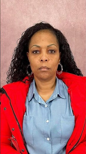 Mid Facelift Transformation- Plastic Surgery Done Right