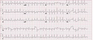 McConnell’s Sign Still Holds Its Value: A Lesson Learned from Two Cases