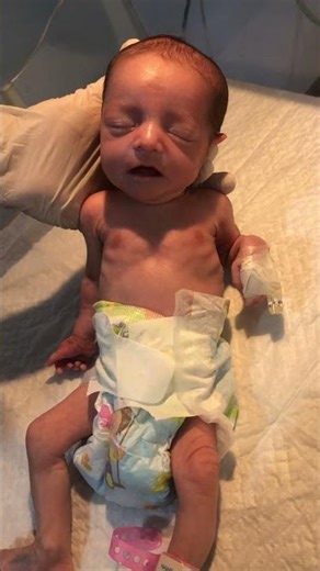 Newborn Baby Girl 💓👶 | Cute & Adorable Moments 💖 #NewbornBaby #BabyGirl