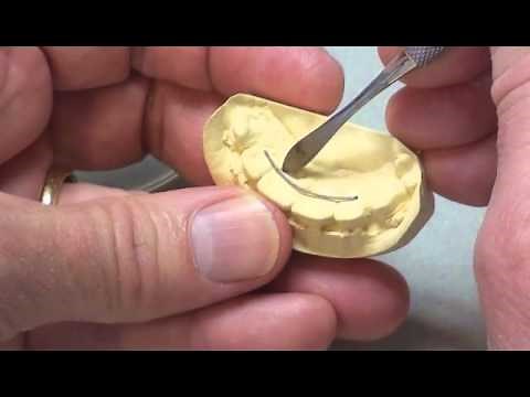 Bonded Lingual Retainers