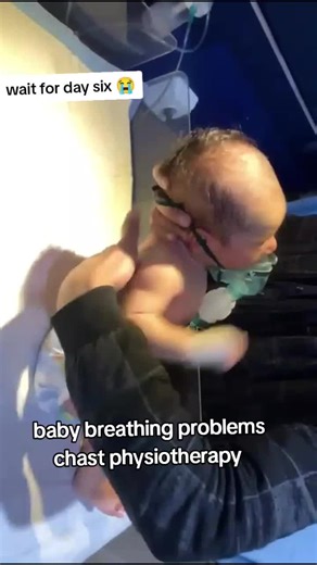 Understanding Baby Breathing Problems and NICU Awareness