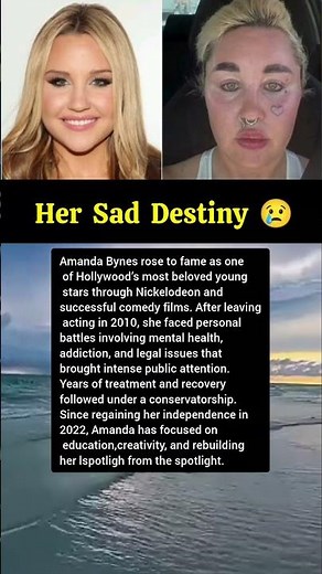 Amanda Bynes’ Rise, Breakdown & Recovery. #amandabynes