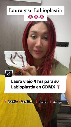 Labioplastia en Ciudad de México: La experiencia de Laura