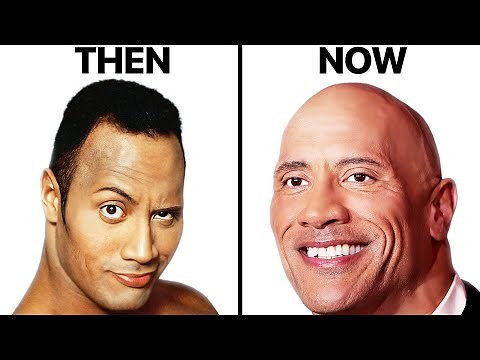 The Rock Hair Loss Analysis | Is Bald The Answer?