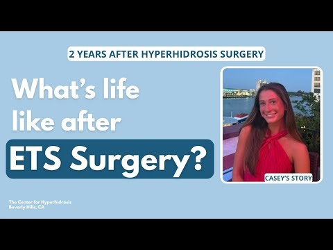 Casey | Life Since Hyperhidrosis Surgery (ETS) Full Interview