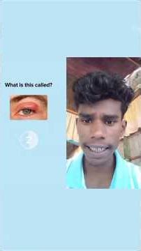 What is this called?#funny #dailyvideo #comedy