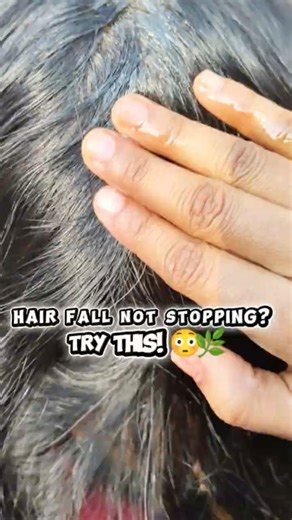 Hair Fall Not Stopping? Try This DIY Hair Growth Oil 🌿#haircare#homemade#youtube#short