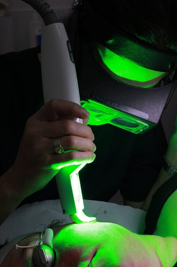 Vascular Laser Treatment, Laser Therapy - Melbourne Skin & Dermatology Clinic