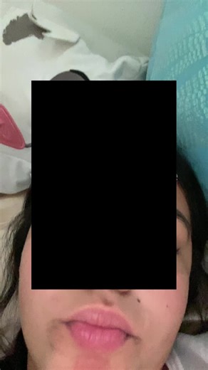 Effective Strategies for Acne Management