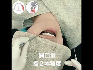 基本検査ポジション・レスト 06. 左上4-7 解説編