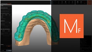 Refine every detail of your bar design using advanced tools for gingiva cut, bar adaptation and splitting. Watch the full process and learn how to enhance accuracy in your daily work with Zirkonzahn.Modifier. Get your free licence here 👉 https://products.zirkonzahn.com/page/Zirkonzahn-Modifier-Try-and-Go/v/EN | Zirkonzahn Worldwide