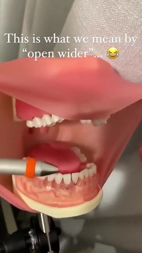 How to Open Your Mouth at the Dentist