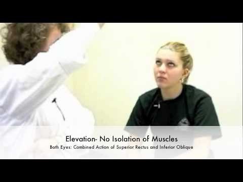 Testing Extraocular Muscles
