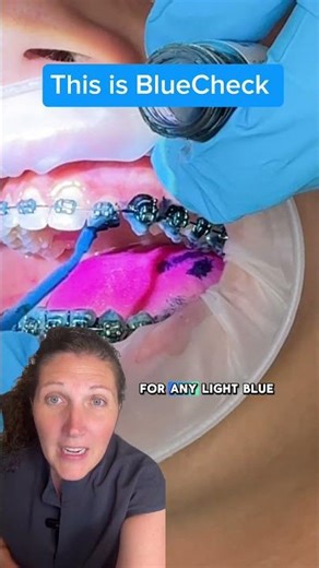 Teaching students to spot disease earlier with BlueCheck