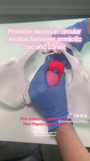 Membrane Sweep for Labor Induction Explained