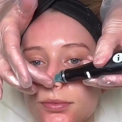 Get that dewy, glass skin with the best Hydrafacial experience here at BOSS Aesthetics! 🏆 This month, we're offering our Hydrafacial for ONLY $149! Prepare to dazzle like never before ✨ Click "GET OFFER" to claim your spot and pamper your skin with the love it deserves! 😍👇 | BOSS Aesthetics