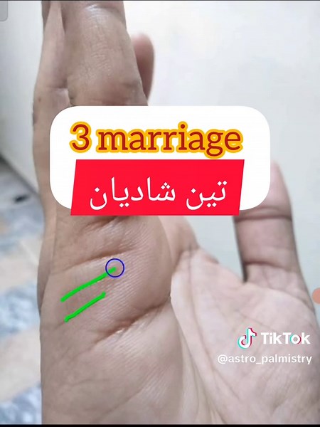 Understanding Three Marriage Lines in Palmistry