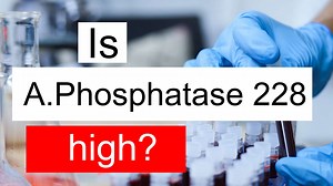 Is Alkaline phosphatase 228 high, normal or dangerous? What does ALP level 228 mean?