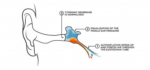 What Is Otovent Used For | Ear Pressure Relief | Glue Ear Remedy