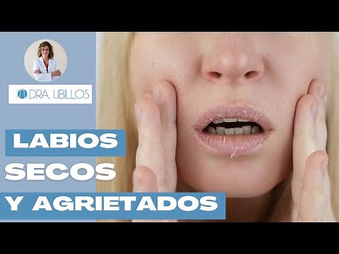 HOW TO IMPROVE DRY AND CHAPTED LIPS