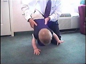 Neurologic Exam-Pediatric | 12-month-old | Normal | Motor/Postural Reflexes - Parachute