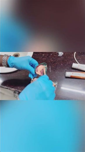 Complete denture impression #OralVibe