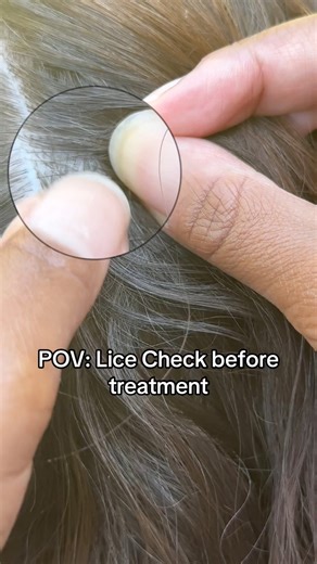 Lice check before treatment #explore #momlife #lice #school #piojos | Stacey The Louse Lady