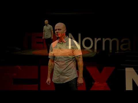 Normal is a Relative Term | Matthias Pope | TEDxNormal