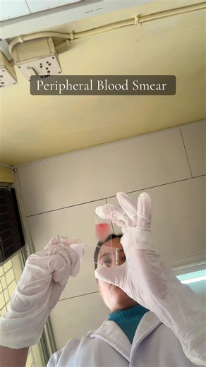 Understanding Peripheral Blood Smear in Medical Labs