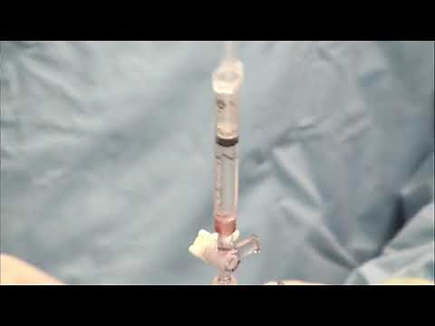 Stingray Balloon Prep