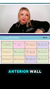 ⭐Save this video for 12 lead ECG reviewing!⭐ This is just a snippet of my 12 Lead ECG Interpretation: An Easy Approach on demand webinar! If you are struggling to interpret ECG's, or just need a refresher with CE's, this course is definitely for you! This course uses an organized and succinct method of analyzing a 12 lead ECG specifically in patients experiencing suspected acute coronary syndrome. Repetitive practice with interpreting 59 - 12 lead ECGs identifying STEMI, NSTEMI and STEMI mimics.