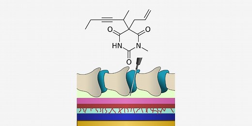 Anesthetics Nursing Considerations & Management - RNpedia