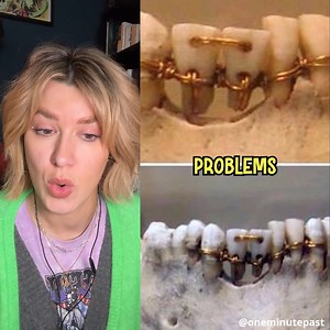 100K views · 2.9K reactions | Ancient Egyptians: The Earliest Form Of Dentistry! 醴 | Jahannah James | Facebook