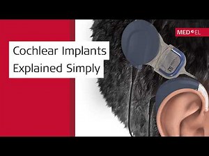 How Do Cochlear Implants Work? | SYNCHRONY & SONNET 3