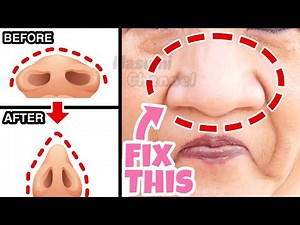 Best Nose Slimming Exercises to Reshape Nose Fat, Get Slim Nose Without Surgery👃