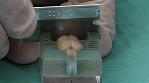 Measuring Post-Stroke Cerebral Edema, Infarct Zone and Blood-Brain Barrier Breakdown in a Single Set of Rodent Brain Samples