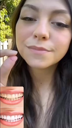 Home remedy for teeth whitening #teethwhitening #fyp #foryoupage #skincare #trending #viral