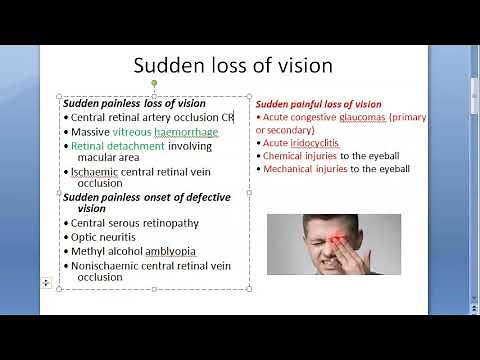 Ophthalmology Sudden loss of vision Painless Painful defective cause reason