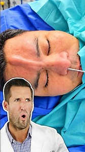 ER Doctor REACTS to Satisfying Nose Procedure