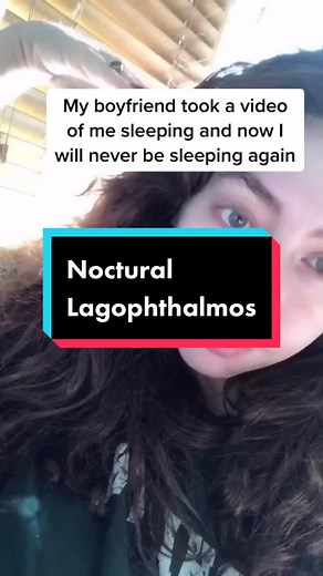Protect Your Eyes: Nocturnal Lagophthalmos Prevention Tips