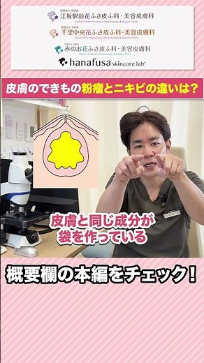 Is that lump just acne? A dermatologist explains the truth about 5 types of sebaceous cysts that ...