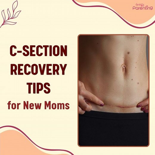 C-Section Recovery Tips for New Moms