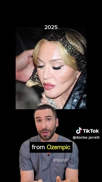 Madonna's Transformation 2023 vs 2025: Aesthetic Analysis