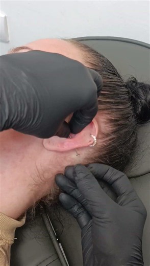 Conch piercing