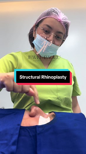 Understanding Structural Rhinoplasty Techniques