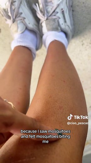 Mosquito Bites vs Bed Bug Bites: Spotting the Difference